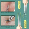 TsMADDTs Blackhead Remover Tools, Ingrown Hair Removal Kit Blackhead Remover