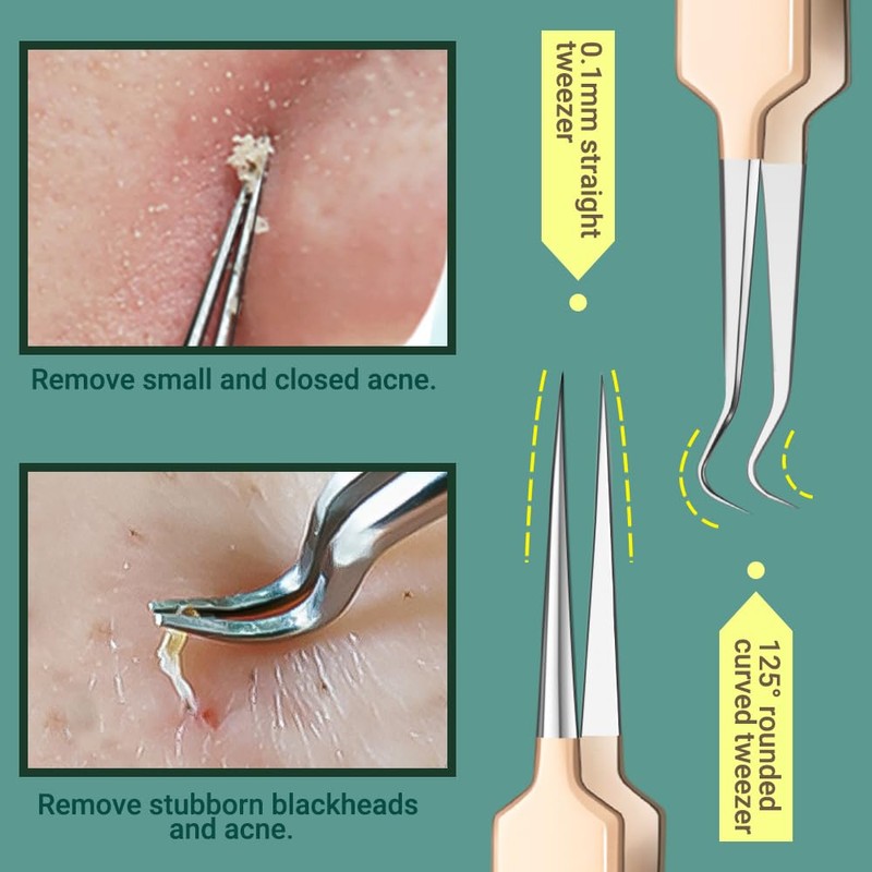 TsMADDTs Blackhead Remover Tools, Ingrown Hair Removal Kit Blackhead Remover