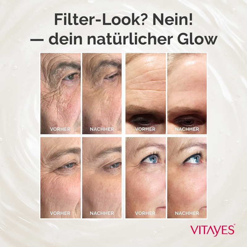 - Instant Ageback (7ml) Lifting Cream For Wrinkles, Bags And