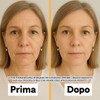 BIOVITALIZE Vitamin C Facial Serum - Brightening, Anti-Wrinkle and Spot