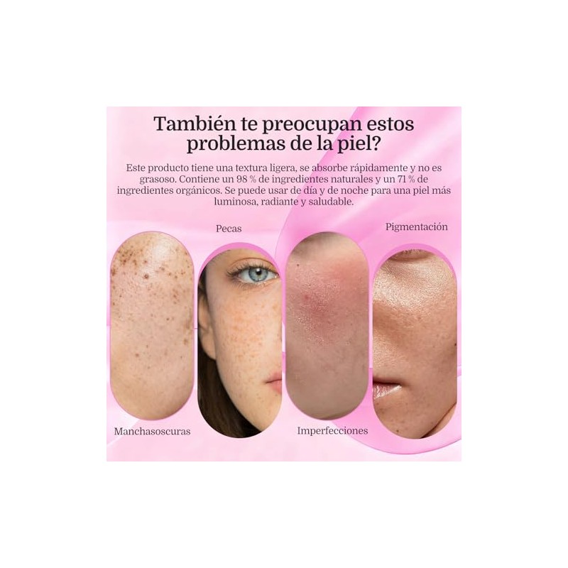 Txa Cream Crema Manchas Faciales Cremas Aclaramiento Piel Oscuras Pecas