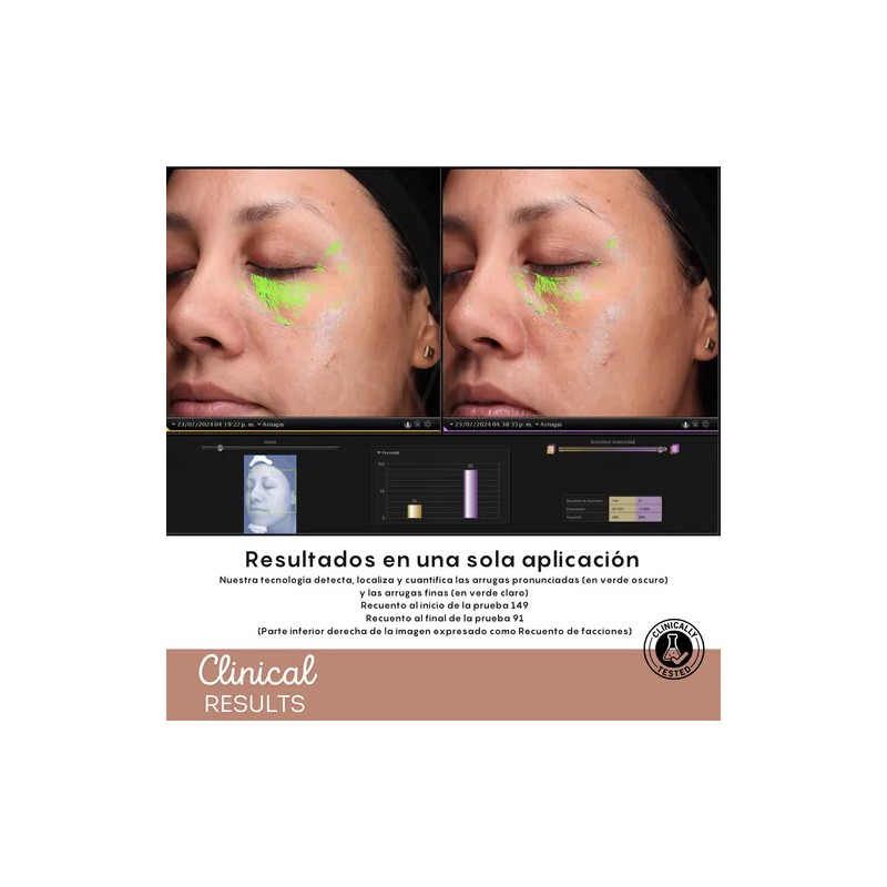 Suero Lifting Facial Inmediato Y Progresivo Tensor Facial Momento de