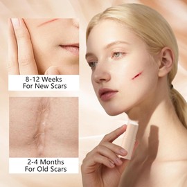 3 piezas Barra De Silicona Para Cicatrices Scar,Con Extractos De Centella AsiáTica Y Vitamina E,Para Rostro Y Cuerpo,Hidratante, Ligera Y FáCil De Aplicar, Suave Para Todo Tipo De Piel.Durabilidad