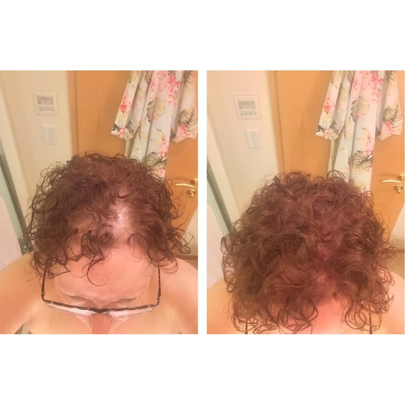 Caboki Value Pack 4, 360-Day Supply (Light Auburn)