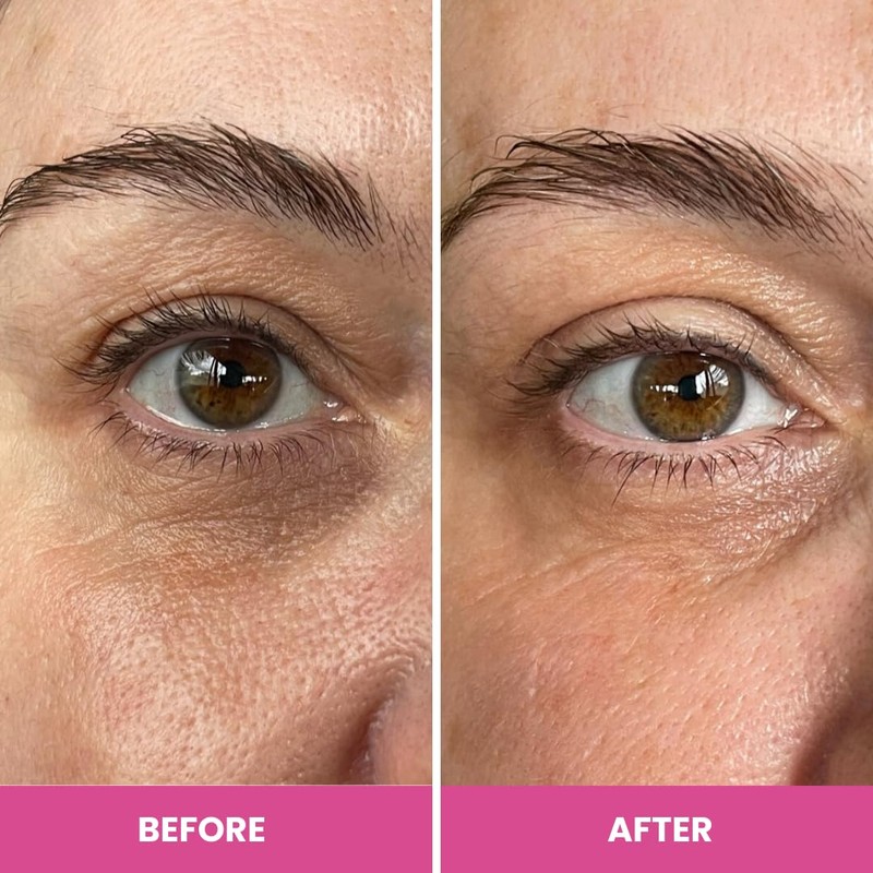 Prime Prometics PrimeEyes Hydrate Under Eye Cream for Mature Women