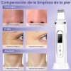 Ciicii® Espátula Ultrasónica , Limpiador Ultrasónico Facial Con 3 Modos,