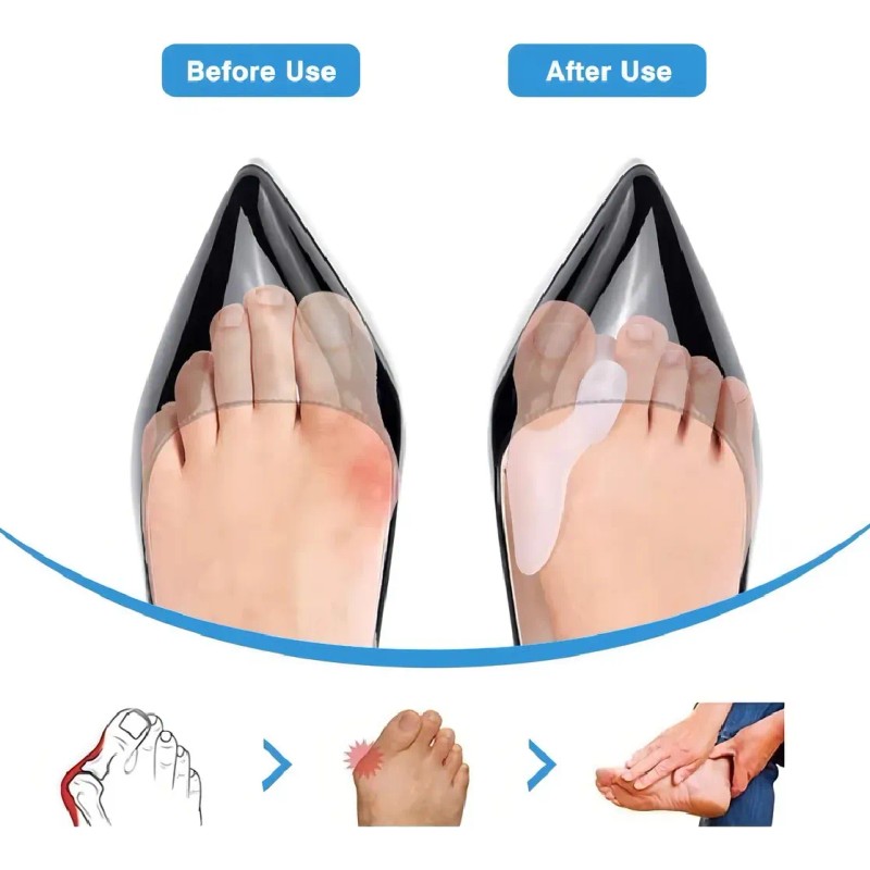 5 Pzas Corrector Y Separadores De Juanete Ajustable Gris Universal