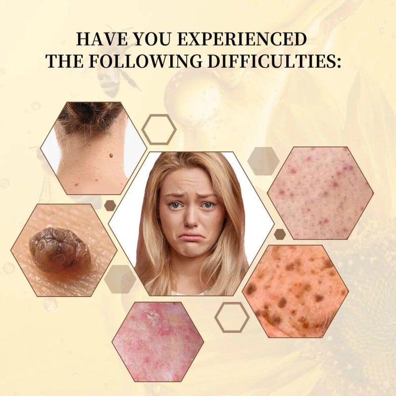 2pcs Crema Correctora Natural De Abeja For El Cuerpo 120g