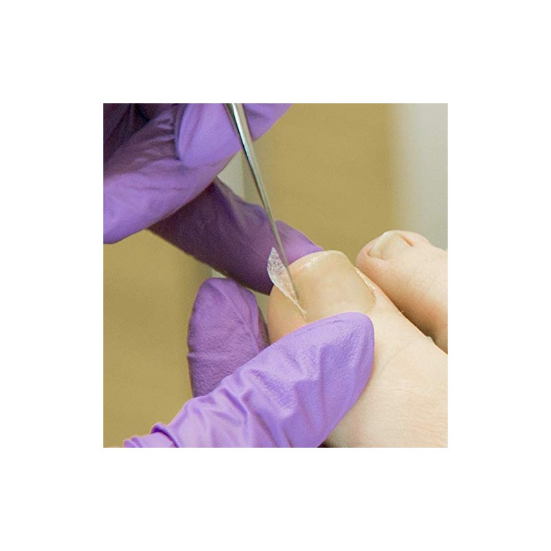 Kosmetex 2 x tamponade for toenails and the nail fold,