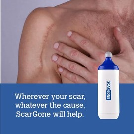 ScarGone Scar Minimising Massager – Effective Treatment for Face & Body, Targets Keloid, Acne, Burn, Dark, and Surgical Scarring – Reduces Appearance of New & Old Wounds