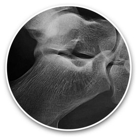 Vinyl Stickers (Set of 2) 7.5cm (bw) - Human Foot Ankle X-Ray Doctor Laptop Tablet Luggage Scrapbook #43048