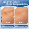 Advanced Silicone Scar Gel for Face & Body – Silicone
