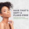 Avalon Organics Anti-Dandruff Itch & Flake Conditioner, 14 Ounce