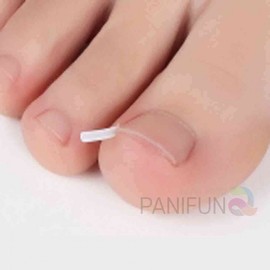 Funny ingrown toenail wire tip 10p toenail correction tip ingrown toenail toenail tape Ingrown toenail tip 10p 5ea