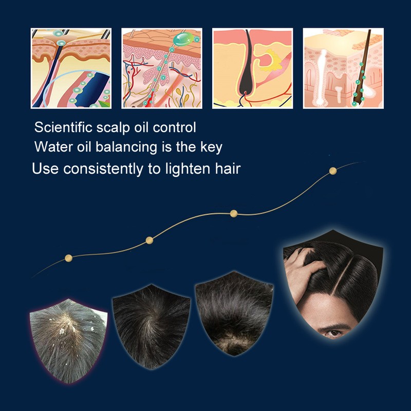 Silicone Free Shampoo Anti Dangdruff Shampoo Oil Control Shampoo for