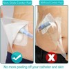 12"x13.7" Waterproof Shower Cover Incision Bandages for Large Wound with