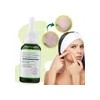 Liquido Antiacne Serum Reparador Espinillas Acido Salicilico