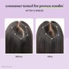 Lemme Suplemento Crecimiento Cabello Mujeres Complejo Queratina Clínicamente Probado Cuero
