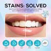 Venus Visage Dazzle Dust Teeth Whitening Powder - Enamel-Safe Toothpaste