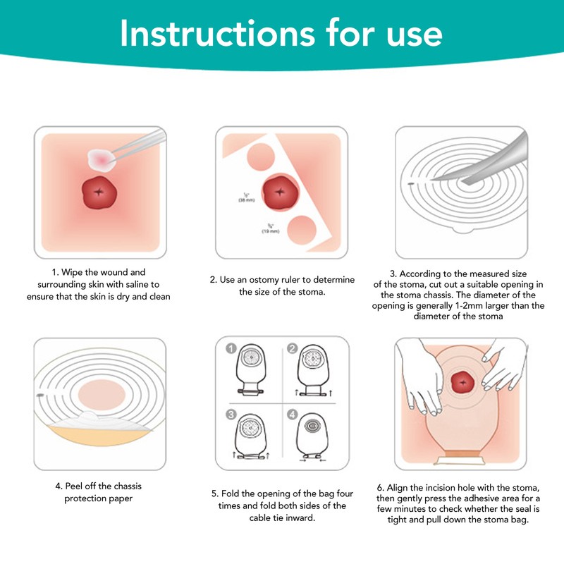 10pcs Colostomy Bag Disposable Adhesive One Piece Drainable Ostomy Pouch