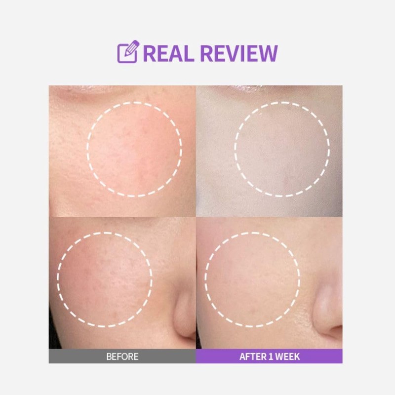 Ampolleta Meoru Podo Vita C Dark Spot Ampoule de Sungboon