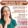 Pack of 2 Gum Gel, Gum Recovery Drops, Gum Repair