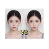 Global HLS Lifting Ear Correction Stickers V-Line Face Lifting Patch