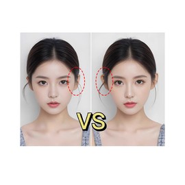 Global HLS Lifting Ear Correction Stickers V-Line Face Lifting Patch Instant Elasticity Care