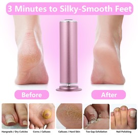 Foot Callus Remover for FootHealth, Electric Foot File, Foot Sander and Nail Drill with 60pcs Sandpapers 20pcs Grinding Heads, Lima para Los Pies Pink