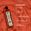 Tratamiento Shampoo Anticaída Árbol Verde 4pzs Romero Sábila