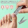Chisafly Rolling Nail Clips, Rolling Toenails, Foot Coiled Toenails [10