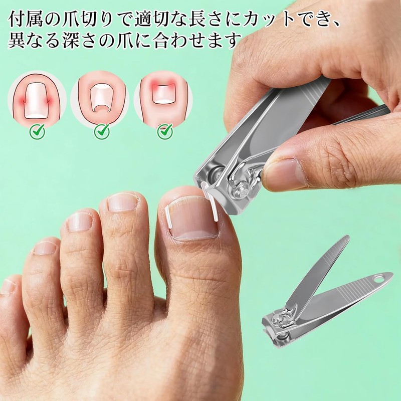 Chisafly Rolling Nail Clips, Rolling Toenails, Foot Coiled Toenails [10