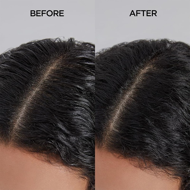 AYUNCHE Refreshing Shampoo for Oily Scalp, 11.8oz Purifying & Cool