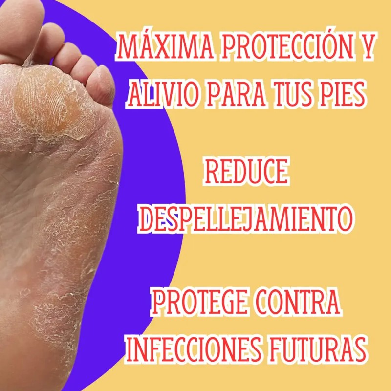 2 Pzas Crema Contra Pie De Atleta Antihongos 60ml Bella