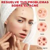 180pzs Parches Pegatinas Para Acné Absorbentes Pimple Patch