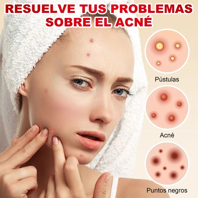 180pzs Parches Pegatinas Para Acné Absorbentes Pimple Patch