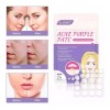 Universo en Linea 24 Parches Acne Dia Y Noche Quita