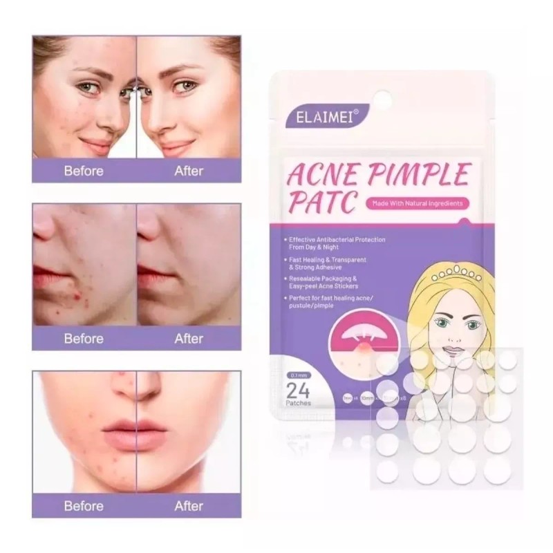Universo en Linea 24 Parches Acne Dia Y Noche Quita