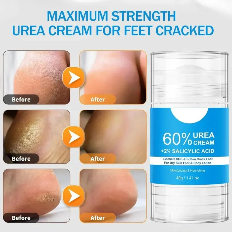 H Ai //crema De Urea De Máxima Potencia For Pies,