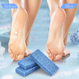 SALVMARY Foot Pumice Stone for Feet Callus Remover, Disposable New Sharper Pumice Scrubber Sponge Pads Pedicure Tools for Salons, 40 Pcs Blue