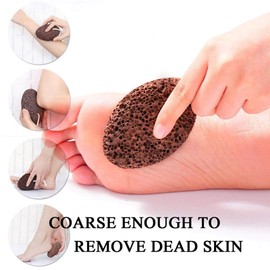 PHOGARY Natural Pumice Stone for Feet, 1 Pack Volcanic Lava Foot Stone Pedicure Tools Hard Skin Callus Remover for Feet and Hands - Natural Foot File Exfoliation to Remove Dead Skin