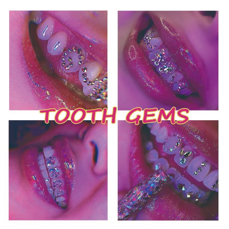 Neeyer 1000 Gems DIY Tooth Gem Kit, Fashion Teeth Jewelry