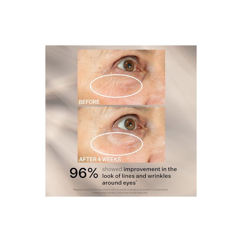 StriVectin Peptight 360˚ Tightening Eye Serum, 1 fl. Oz