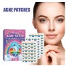 Wiieey Patch Acne Parches Hidrocoloide Facial 216 Pzs
