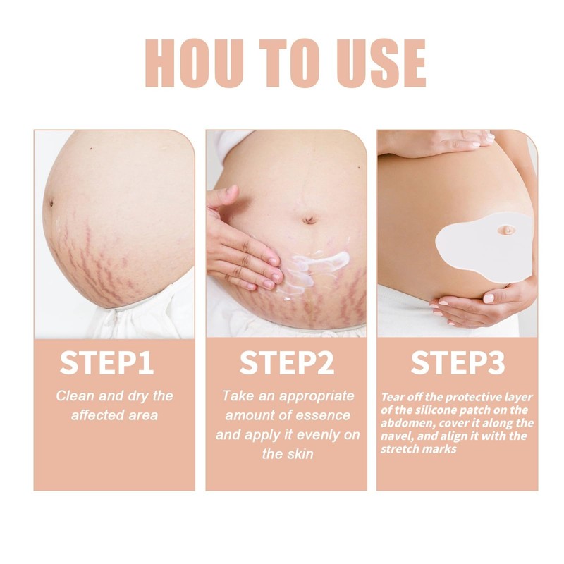 Silicone Patches for Stretch Marks, Anti Wrinkle Stretch Removal Sheet