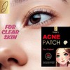 ibrar's Acne/Pimple Patches, Invisible Hydrocolloid 36 patches in Pack.