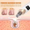 IGEAIIE Blackhead Remover Vacuum, Pore Vacuum with 5 Replaceable Suction