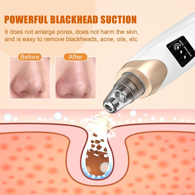 IGEAIIE Blackhead Remover Vacuum, Pore Vacuum with 5 Replaceable Suction
