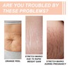 Silicone Patches for Stretch Marks, Anti Wrinkle Stretch Removal Sheet