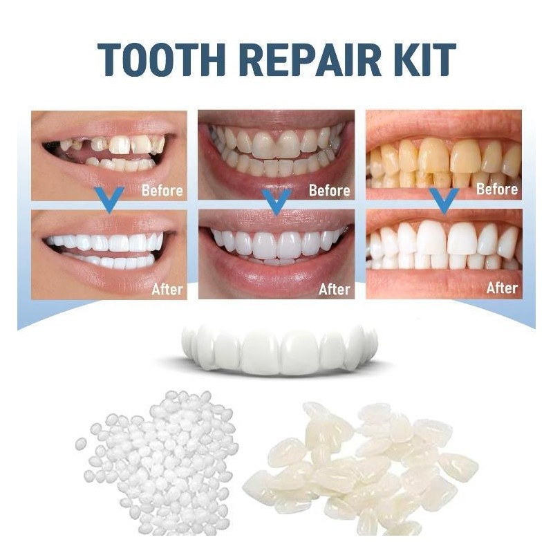 UAYSUING Shapeable Denture Pellets - Mouldable False Teeth Solution for